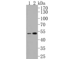 Invitrogen ZPR1 Recombinant Rabbit Monoclonal Antibody (JE58-88) 100 &mu;L | Buy Online | Invitrogen&trade; | Fisher Scientific