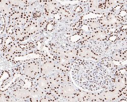 Invitrogen CPSF3 Recombinant Rabbit Monoclonal Antibody (JE59-11) 100 &mu;L;