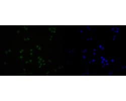 Invitrogen SNRPA1 Recombinant Rabbit Monoclonal Antibody (JE56-64) 100