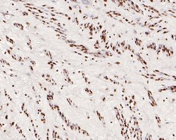 Invitrogen SNRPA1 Recombinant Rabbit Monoclonal Antibody (JE56-64) 100