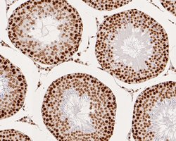 Invitrogen SNRPA1 Recombinant Rabbit Monoclonal Antibody (JE56-64) 100
