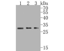 Invitrogen SNRPA1 Recombinant Rabbit Monoclonal Antibody (JE56-64) 100