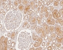 Invitrogen OLIG3 Recombinant Rabbit Monoclonal Antibody (JE56-40) 100 &mu;L;