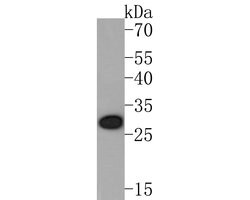 Invitrogen OLIG3 Recombinant Rabbit Monoclonal Antibody (JE56-40) 100 &mu;L;