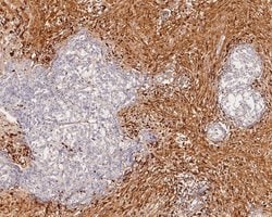 Invitrogen Kappa Light Chain Recombinant Rabbit Monoclonal Antibody (JE56-54)
