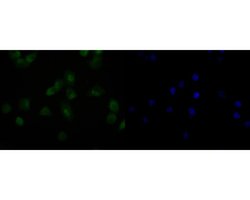 Invitrogen HDGF Recombinant Rabbit Monoclonal Antibody (JE56-90) 100 &mu;L;