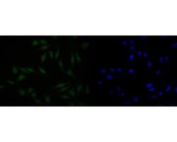 Invitrogen HDGF Recombinant Rabbit Monoclonal Antibody (JE56-90) 100 &mu;L;