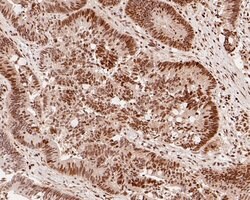 Invitrogen HDGF Recombinant Rabbit Monoclonal Antibody (JE56-90) 100 &mu;L;