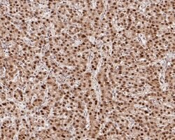 Invitrogen HDGF Recombinant Rabbit Monoclonal Antibody (JE56-90) 100 &mu;L;