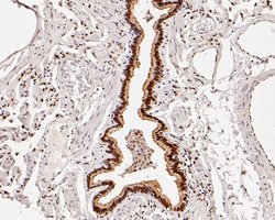 Invitrogen HDGF Recombinant Rabbit Monoclonal Antibody (JE56-90) 100 &mu;L;