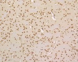 Invitrogen HDGF Recombinant Rabbit Monoclonal Antibody (JE56-90) 100 &mu;L;