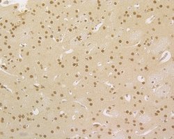 Invitrogen HDGF Recombinant Rabbit Monoclonal Antibody (JE56-90) 100 &mu;L;