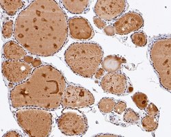 Invitrogen CHD3 Recombinant Rabbit Monoclonal Antibody (JE57-05) 100 &mu;L;