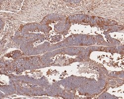 Invitrogen ERLIN2 Recombinant Rabbit Monoclonal Antibody (JE57-03) 100