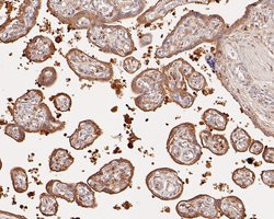 Invitrogen ERLIN2 Recombinant Rabbit Monoclonal Antibody (JE57-03) 100