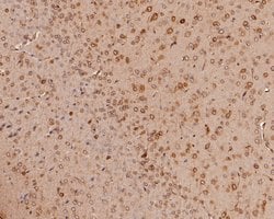 Invitrogen ERLIN2 Recombinant Rabbit Monoclonal Antibody (JE57-03) 100