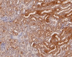 Invitrogen ERLIN2 Recombinant Rabbit Monoclonal Antibody (JE57-03) 100
