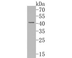 Invitrogen ERLIN2 Recombinant Rabbit Monoclonal Antibody (JE57-03) 100