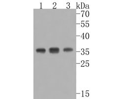 Invitrogen MED4 Recombinant Rabbit Monoclonal Antibody (JE56-55) 100 &mu;L;