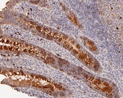 Invitrogen ACAA2 Recombinant Rabbit Monoclonal Antibody (JE56-67) 100 &mu;L;
