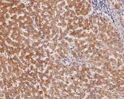 Invitrogen ACAA2 Recombinant Rabbit Monoclonal Antibody (JE56-67) 100 &mu;L;