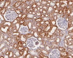Invitrogen ACAA2 Recombinant Rabbit Monoclonal Antibody (JE56-67) 100 &mu;L;