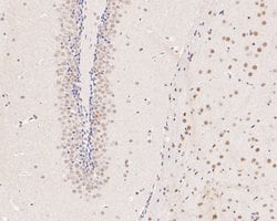 Invitrogen METTL3 Recombinant Rabbit Monoclonal Antibody (JE58-20) 100