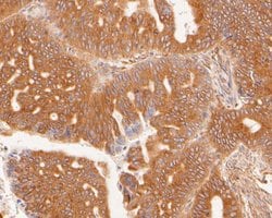 Invitrogen SLC27A4 Recombinant Rabbit Monoclonal Antibody (JE58-29) 100