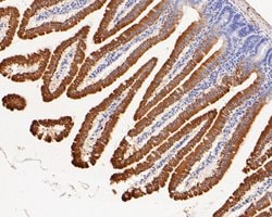 Invitrogen SLC27A4 Recombinant Rabbit Monoclonal Antibody (JE58-29) 100