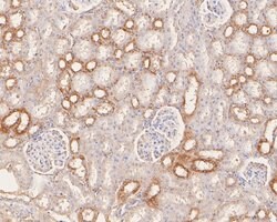 Invitrogen SLC27A4 Recombinant Rabbit Monoclonal Antibody (JE58-29) 100
