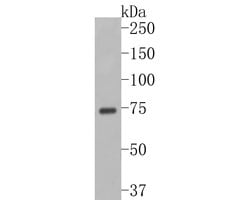 Invitrogen SLC27A4 Recombinant Rabbit Monoclonal Antibody (JE58-29) 100