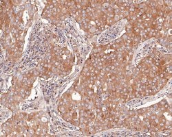 Invitrogen TCP-1 delta Monoclonal Antibody (A8E2) 100 &mu;L; Unconjugated:Antibodies,
