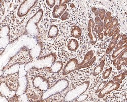 Invitrogen TCP-1 delta Monoclonal Antibody (A8E2) 100 &mu;L; Unconjugated:Antibodies,