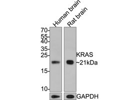 Invitrogen K-Ras Monoclonal Antibody (A8E6) 100 &mu;L | Buy Online | Invitrogen&trade; | Fisher Scientific