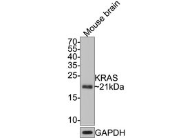 Invitrogen K-Ras Monoclonal Antibody (A8E6) 100 &mu;L | Buy Online | Invitrogen&trade; | Fisher Scientific