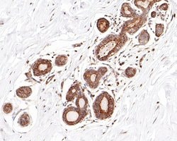 Invitrogen ROBO1 Recombinant Mouse Monoclonal Antibody (10E2-R) 100 &mu;L;