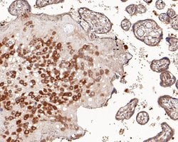 Invitrogen ROBO1 Recombinant Mouse Monoclonal Antibody (10E2-R) 100 &mu;L;