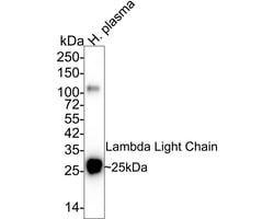 Invitrogen Lambda light chain Monoclonal Antibody (A8G5) 100 &mu;L; Unconjugated:Antibodies,