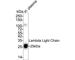 Invitrogen Lambda light chain Monoclonal Antibody (A8G3) 100 &mu;L; Unconjugated:Antibodies,