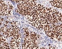 Invitrogen SALL4 Monoclonal Antibody (A7A5) 100 &mu;L; Unconjugated:Antibodies,