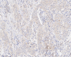 Invitrogen Ephrin A1 Monoclonal Antibody (A7B10) 100 &mu;L; Unconjugated:Antibodies,
