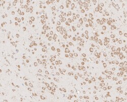Invitrogen Ephrin A1 Monoclonal Antibody (A7B10) 100 &mu;L; Unconjugated:Antibodies,
