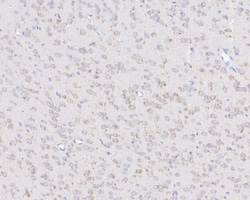 Invitrogen Ephrin A1 Monoclonal Antibody (A7B10) 100 &mu;L; Unconjugated:Antibodies,