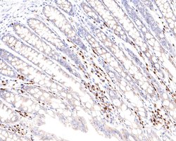 Invitrogen IRF4 Monoclonal Antibody (A7C12) 100 &mu;L; Unconjugated:Antibodies,