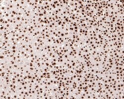 Invitrogen H3K18ac Monoclonal Antibody (A7B5) 100 &mu;L; Unconjugated:Antibodies,