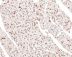Invitrogen H3K18ac Monoclonal Antibody (A7B5) 100 &mu;L; Unconjugated:Antibodies,
