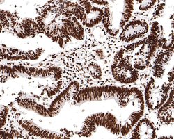 Invitrogen H3K18ac Monoclonal Antibody (A7B5) 100 &mu;L; Unconjugated:Antibodies,