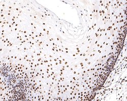 Invitrogen H3K18ac Monoclonal Antibody (A7B5) 100 &mu;L; Unconjugated:Antibodies,