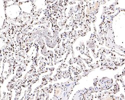 Invitrogen H3K18ac Monoclonal Antibody (A7B5) 100 &mu;L; Unconjugated:Antibodies,