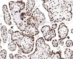 Invitrogen H3K18ac Monoclonal Antibody (A7B5) 100 &mu;L; Unconjugated:Antibodies,